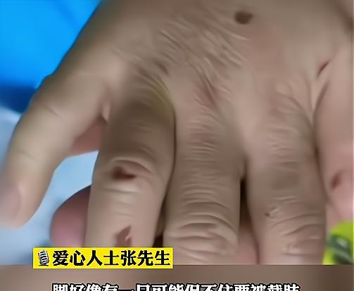 Bé gái bị mẹ kế đánh thập tử nhất sinh, có thể tử vong bất thình lình-3