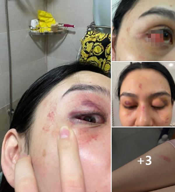 Clip: Nhóm Trang Nemo đuổi cùng giết tận đánh đập team Trần My-1