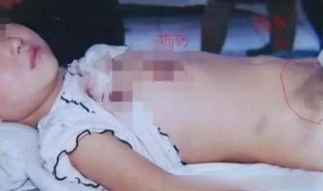 Lỡ ăn miếng thịt của em, bé gái bị mẹ đánh đến nỗi con kiệt sức rồi-1