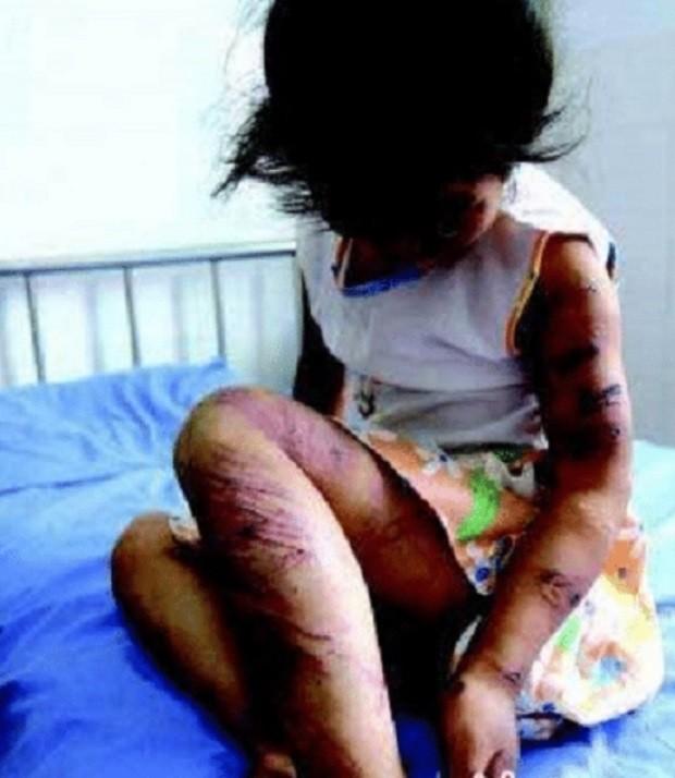 Lỡ ăn miếng thịt của em, bé gái bị mẹ đánh đến nỗi con kiệt sức rồi-2