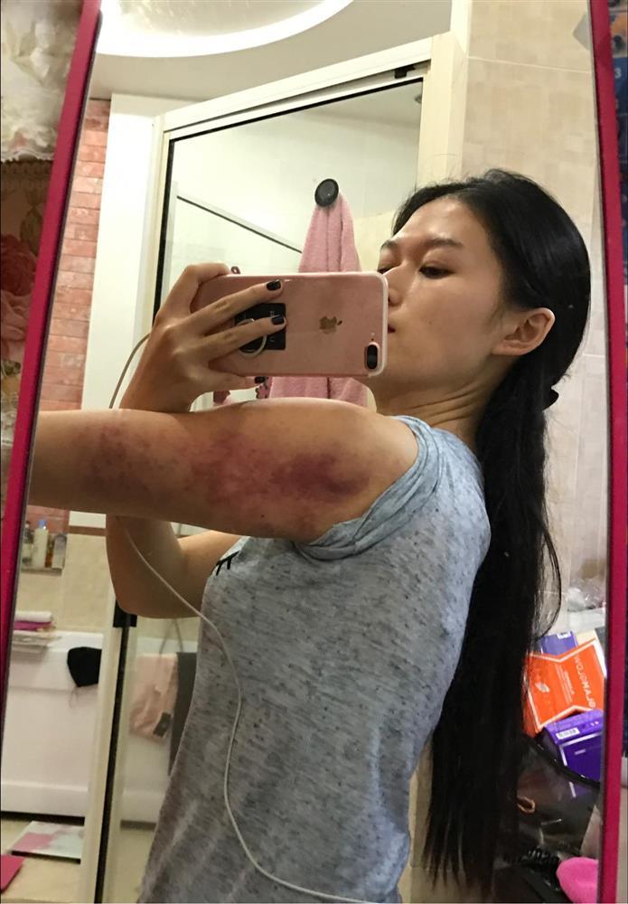 Ngọc Thanh Tâm đăng ảnh bầm người, đá xéo Trang Nemo - Trần My-2