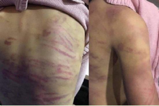 Thêm một bé gái 9 tuổi nghi bị 