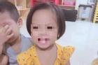Vụ bé 3 tuổi bị bắn 9 đinh vào đầu: Tạm giữ người mẹ và tình nhân