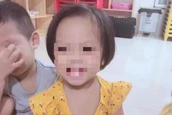 Vụ bé 3 tuổi bị bắn 9 đinh vào đầu: Tạm giữ người mẹ và tình nhân