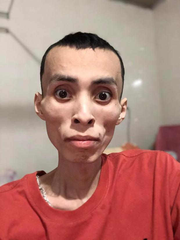 Nam rapper Việt ung thư qua đời ở tuổi 27, đau lòng hình ảnh cuối-3
