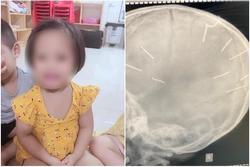 Vụ bé 3 tuổi bị bắn 9 đinh vào đầu: Sao Việt phẫn nộ kẻ ra tay