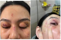 'Chị xã hội' của Trần My bị đánh ở shop Trang Nemo lên tiếng