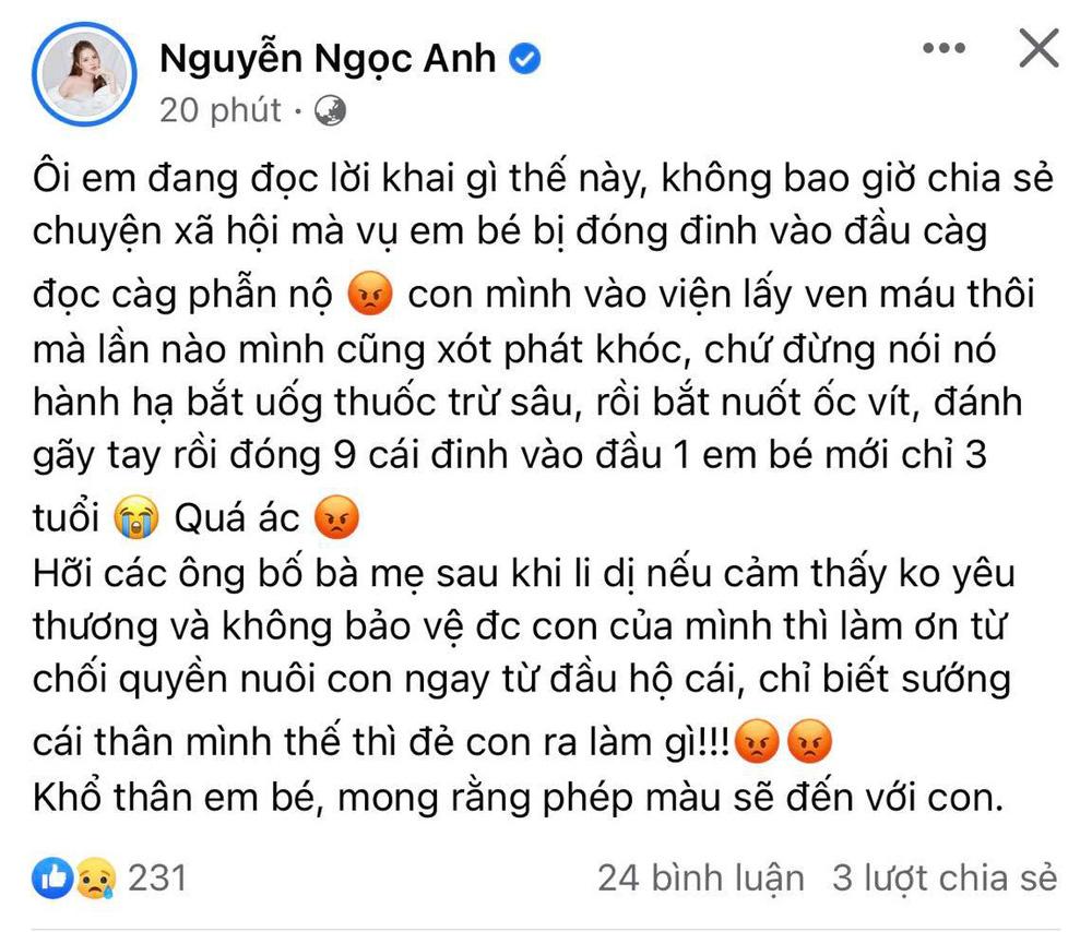 Xôn xao lời khai nghi của kẻ dùng tạ đóng 9 đinh vào đầu bé 3 tuổi-3