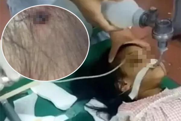 Bị ô tô đâm trúng, cô gái rơi tọt xuống cống thoát nước-2