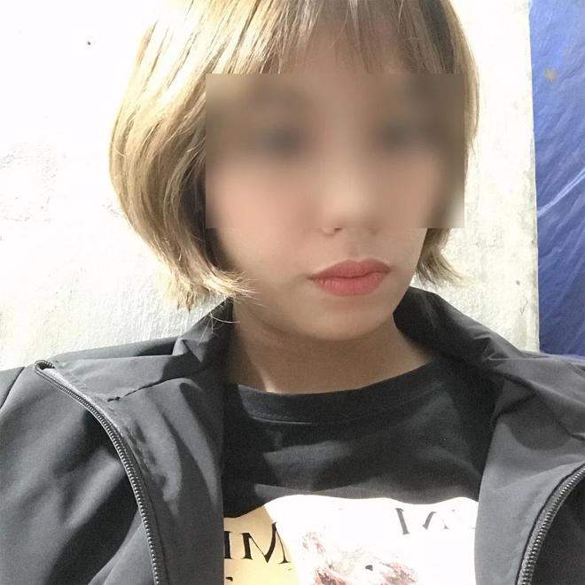 Mẹ bé 3 tuổi nói mình bị sốc khi biết con bị đóng 9 đinh vào đầu-2