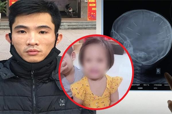 Người tình của mẹ lì lợm không nhận đóng 9 đinh vào đầu bé gái-4