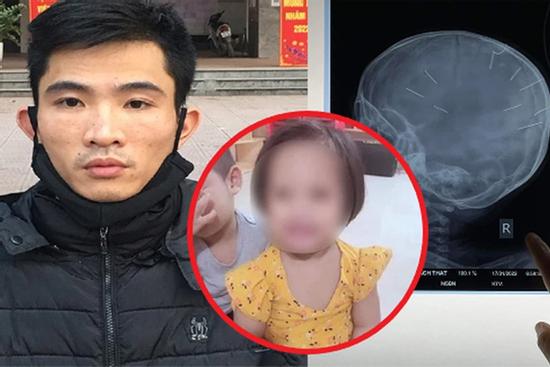 Bé 3 tuổi bị tình nhân của mẹ đóng 9 đinh vào đầu: Mẹ đang ở đâu?
