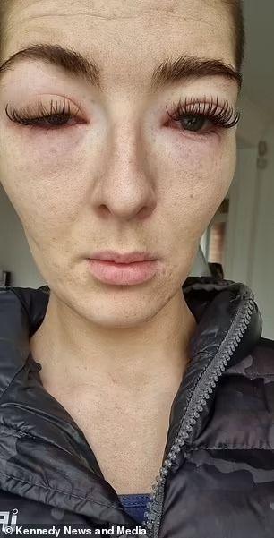 Những tai nạn nối mi kinh hoàng, có cho tiền cũng không dám làm-7