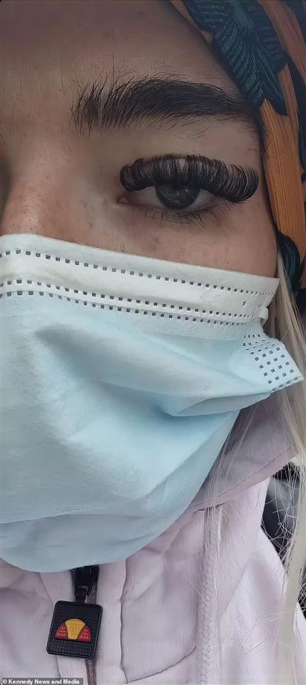 Những tai nạn nối mi kinh hoàng, có cho tiền cũng không dám làm-8