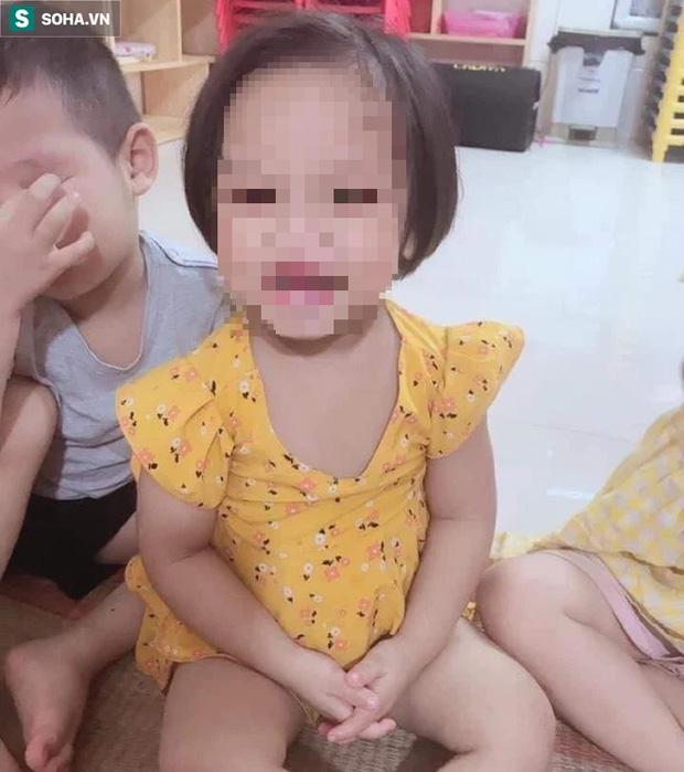 Vì sao bé 3 tuổi bị đóng đinh vào đầu mà không ai biết?-1