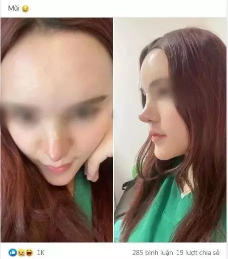 Pha nâng mũi lạ đời nhất hệ mặt trời, nhìn như phù thủy-2