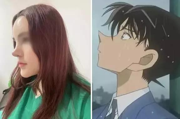 Pha nâng mũi lạ đời nhất hệ mặt trời, nhìn như phù thủy-3