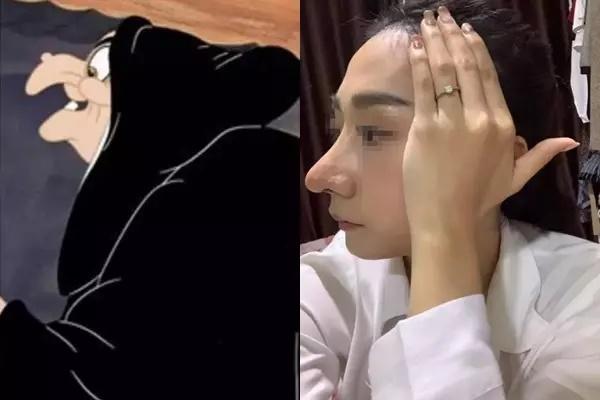 Pha nâng mũi lạ đời nhất hệ mặt trời, nhìn như phù thủy-4