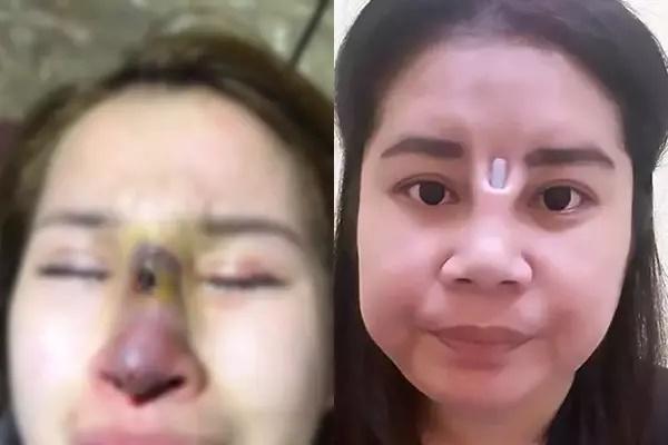 Pha nâng mũi lạ đời nhất hệ mặt trời, nhìn như phù thủy-7