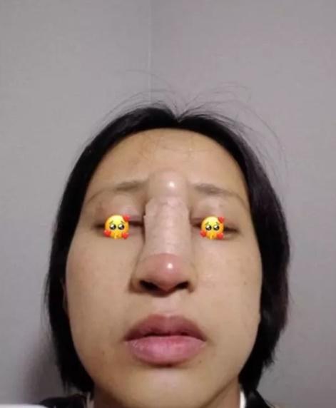 Pha nâng mũi lạ đời nhất hệ mặt trời, nhìn như phù thủy-6