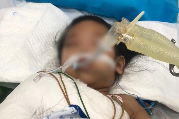 Bé gái 3 tuổi bị ghim 9 cái đinh vào đầu vẫn hôn mê sâu-1