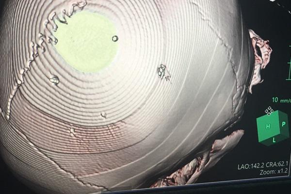 Mâu thuẫn gia đình, người phụ nữ nuốt 12,5 triệu vào bụng-2