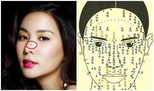 6 nốt ruồi tụ tài lộc, hút vận may, xóa là làm đâu hỏng đấy-1