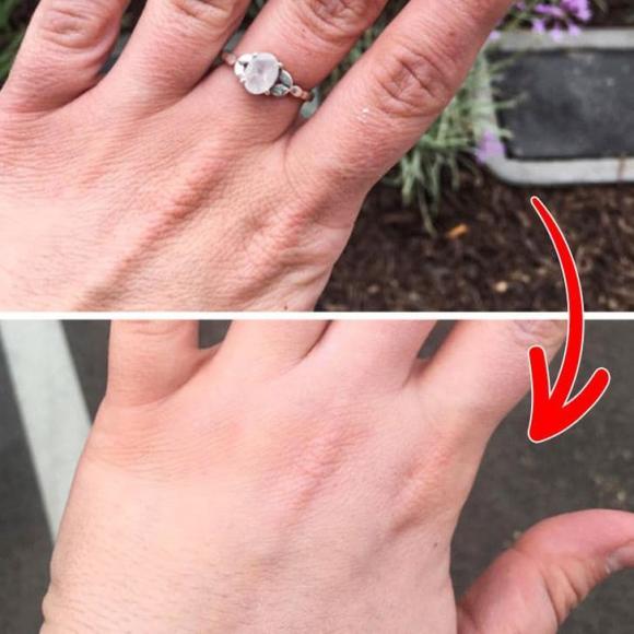 Kem chống nắng có thể làm trẻ hóa da tay-2