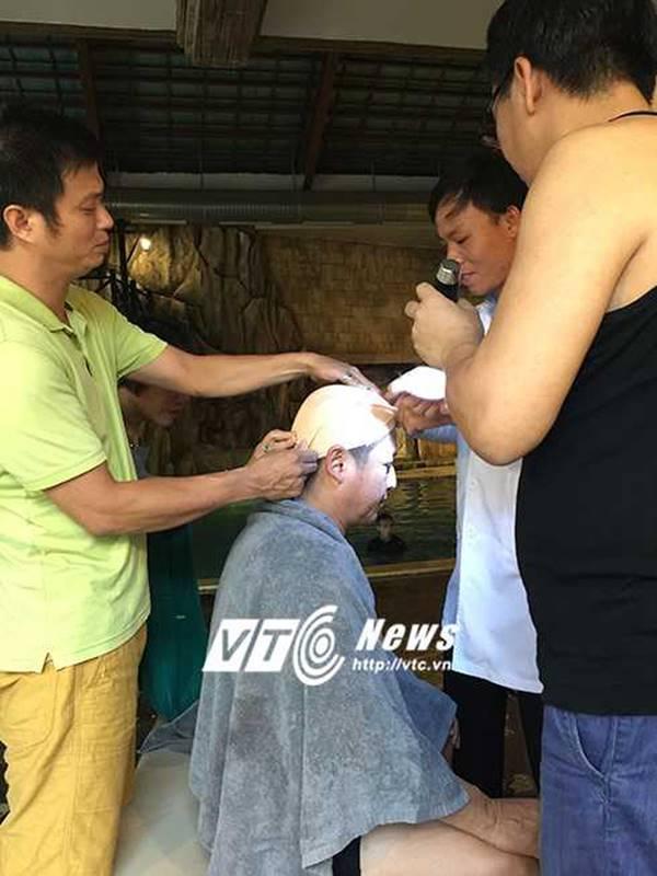 3 lần Táo Giao Thông gặp nạn: Dây thừng thắt đầu, 5 xương sườn gãy, khâu sống 6 mũi-5