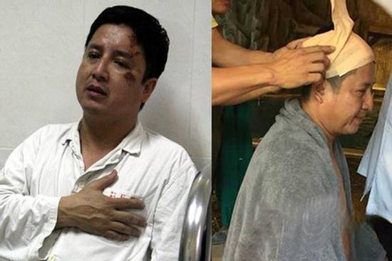 3 lần 'Táo Giao Thông' gặp nạn: Dây thừng 'thắt' đầu, 5 xương sườn gãy, khâu sống 6 mũi