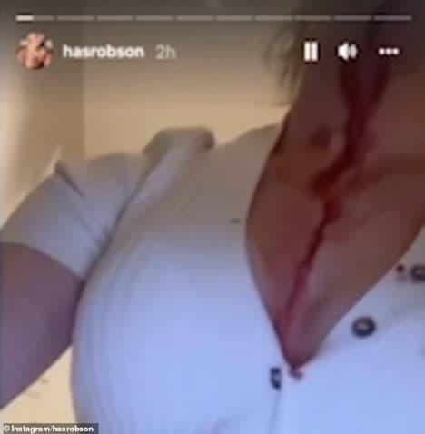 Bạn gái siêu sao Manchester United đăng video bị bạo hành máu me bầm tím-2