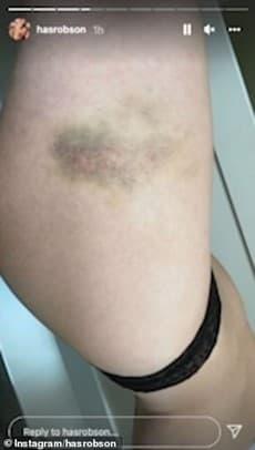 Bạn gái siêu sao Manchester United đăng video bị bạo hành máu me bầm tím-3