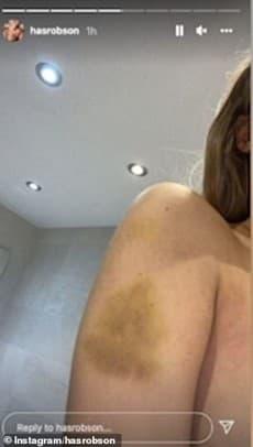 Bạn gái siêu sao Manchester United đăng video bị bạo hành máu me bầm tím-4