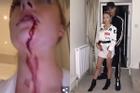 Bạn gái siêu sao Manchester United đăng video bị bạo hành máu me bầm tím