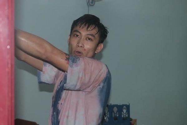 4 người trong một gia đình bị thanh niên nghi ngáo đá đâm, chém trọng thương-2