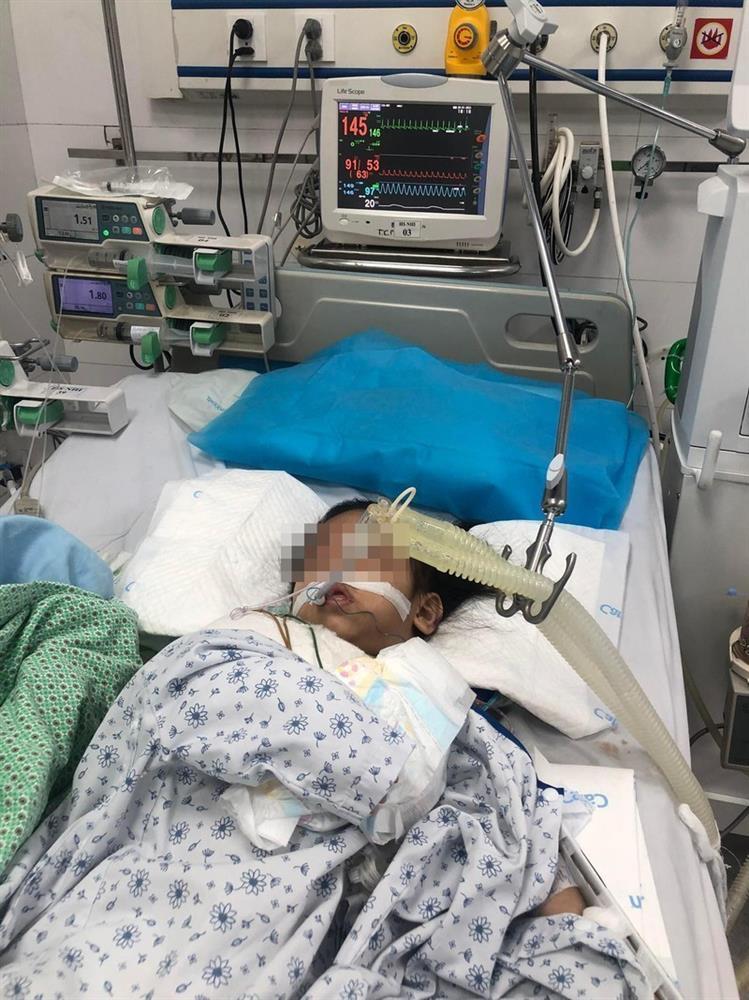 Bé gái bị đóng 9 đinh vào đầu qua cơn nguy kịch, có phản xạ tay chân-2
