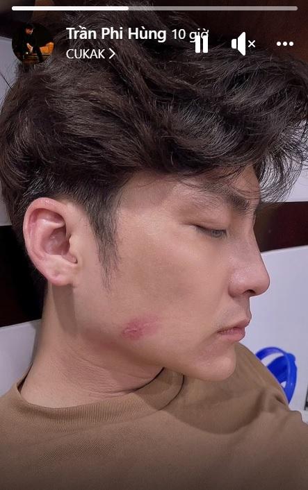 Tố xong Lâm Khánh Chi, Phi Hùng cực cháy với bồ mới-3