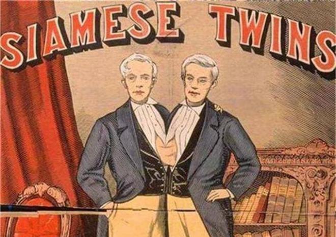 Cuộc sống vợ chồng của hai anh em dính liền thân kết hôn với cặp chị em song sinh-4