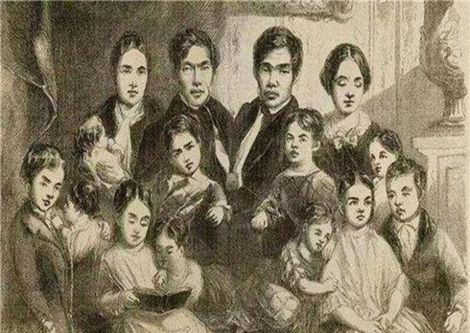 Cuộc sống vợ chồng của hai anh em dính liền thân kết hôn với cặp chị em song sinh-6