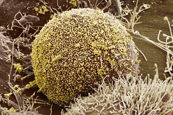 Thêm hai người được tuyên bố chữa khỏi HIV-2