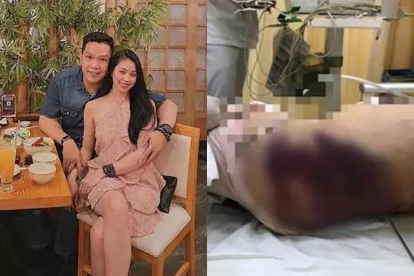 Kiến nghị đổi sang tội Giết người đối với cha bé gái bị bạo hành tử vong-2