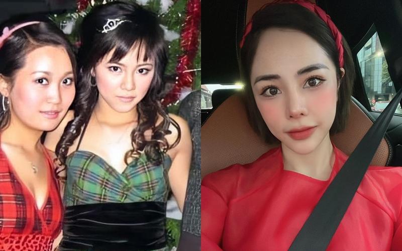 Bạn gái Huỳnh Anh xấu đi vì thẩm mỹ, tiếc nuối dĩ vãng?-4