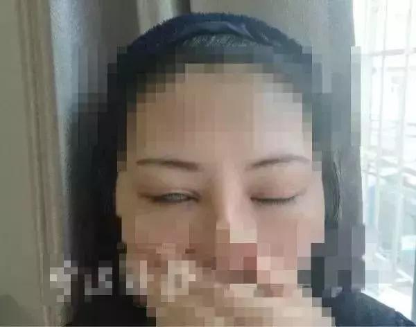 Ám ảnh pha cắt mí mắt lợn lành thành lợn què-6