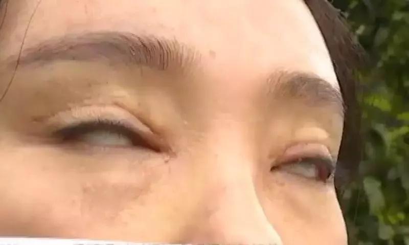 Ám ảnh pha cắt mí mắt lợn lành thành lợn què-7