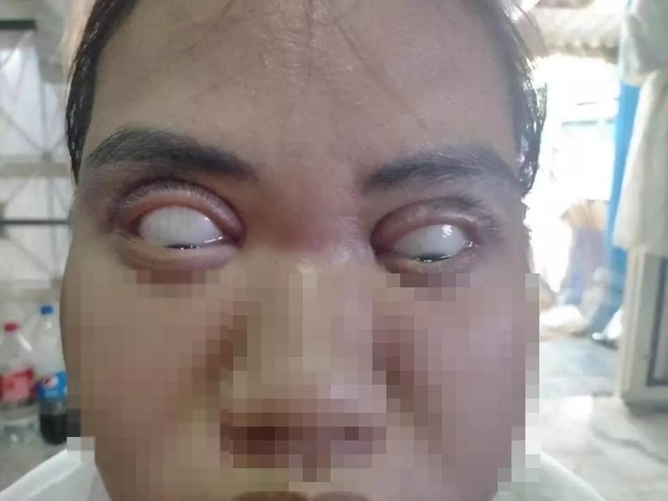 Ám ảnh pha cắt mí mắt lợn lành thành lợn què-2