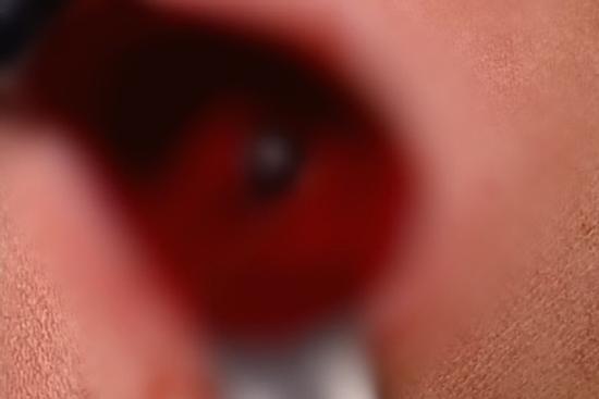 Anh trai 5 tuổi nghịch súng tự chế khiến em 4 tuổi nguy kịch