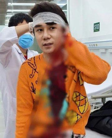 Diễn viên Thương Ngày Nắng Về bị chém sau va chạm giao thông-1