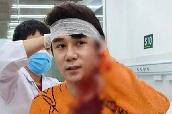 Vụ nam diễn viên bị chém ở Hà Nội: Thương tật dưới 11%, xử lý bị can thế nào?-3