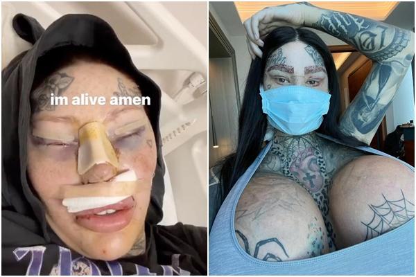 Á Hậu nghiện PTTM rồi chịu hậu quả mặt đơ, mắt trợn ngược-5