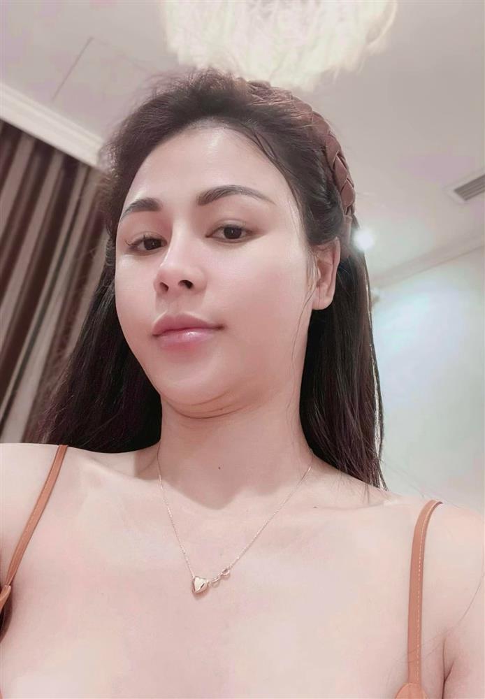 Lương Thu Trang khoe nọng cằm, giải thích nghi án thẩm mỹ hỏng-1